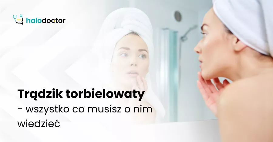 Trądzik torbielowaty - wszystko co musisz o nim wiedzieć