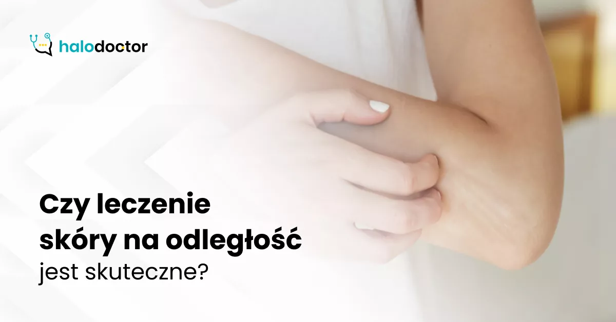Czy leczenie skóry na odległość jest skuteczne?