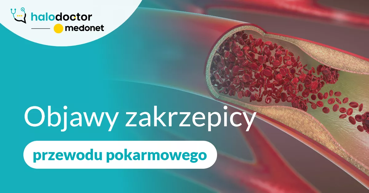  Jakie są objawy zakrzepicy przewodu pokarmowego?