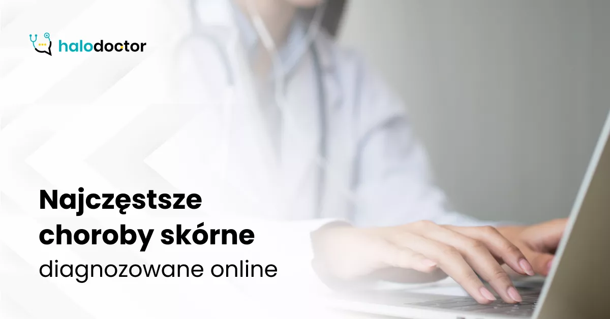 Najczęstsze choroby skórne diagnozowane online
