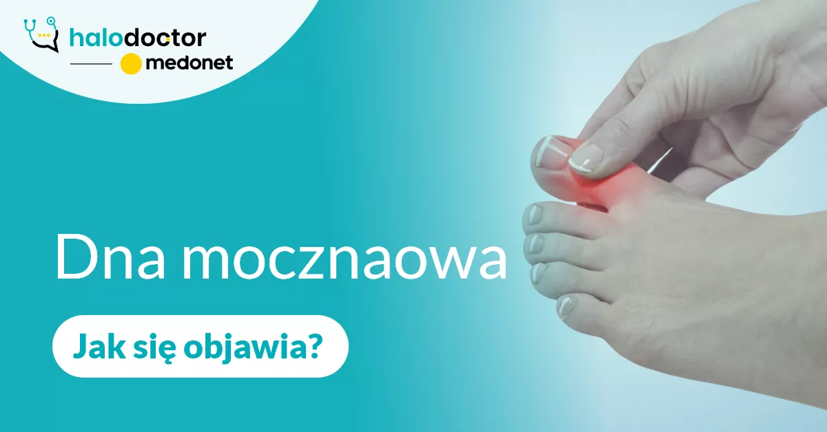 Dna moczanowa, jak się objawia?