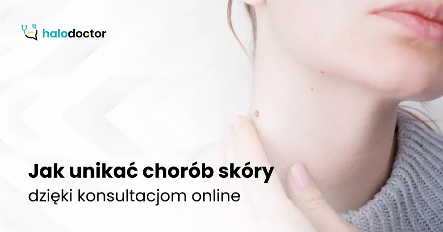 Jak unikać chorób skóry dzięki konsultacjom online
