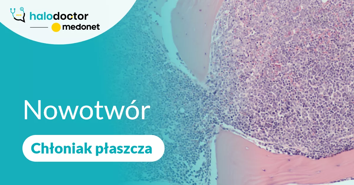 Nowotwór - Chłoniak płaszcza
