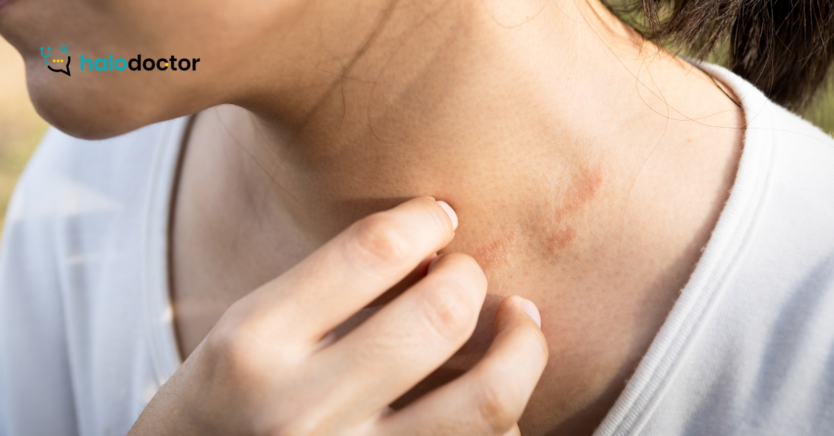 Łuszczyca u dorosłych: jak dermatolog online wspiera leczenie przewlekłe?