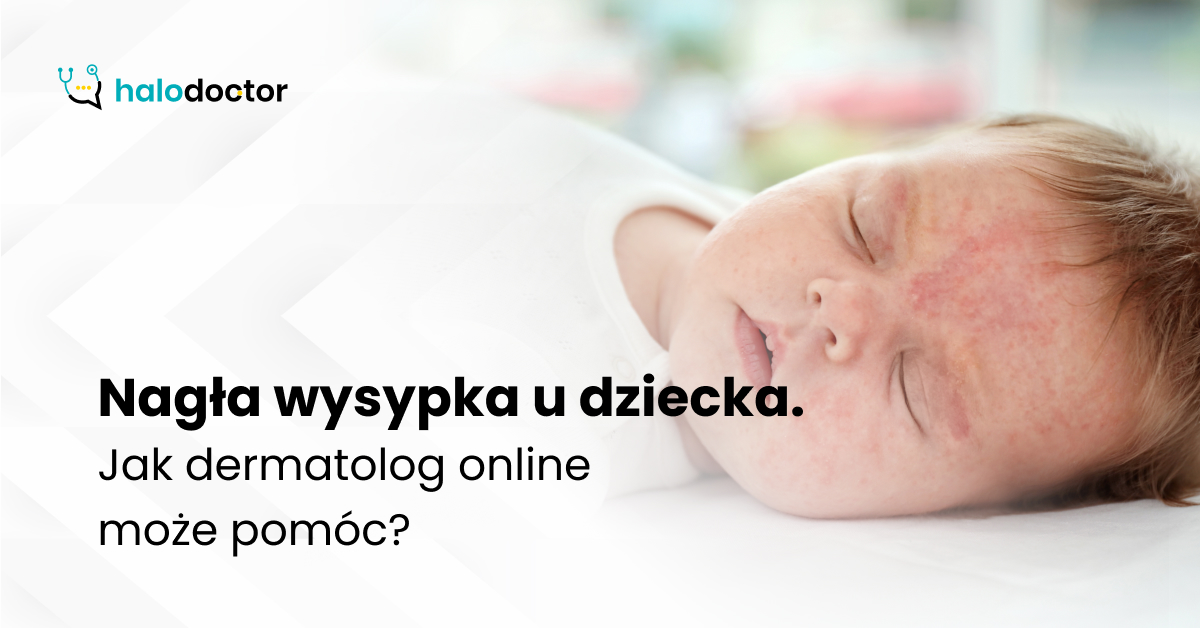 Nagła wysypka u dziecka. Jak dermatolog online może pomóc?